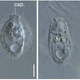 A sampling of the hemimastigotes analyzed in the new study.